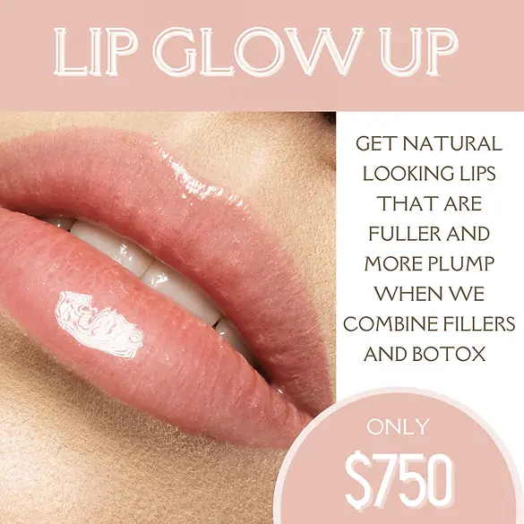 Lip Glow Up Promotion Offer | Glow Aesthetics