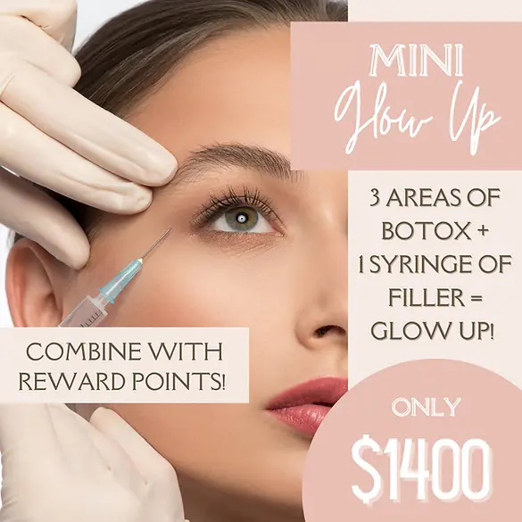 Mini Glow Up Offer | Botox and Filler | Glow Aesthetics