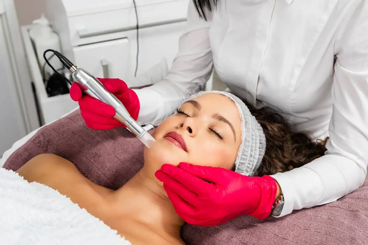 Microneedling with PRP in Glow Aesthetics