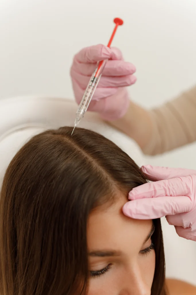 PRP for Hair Restoration in Miami, FL | Glow Aesthetics